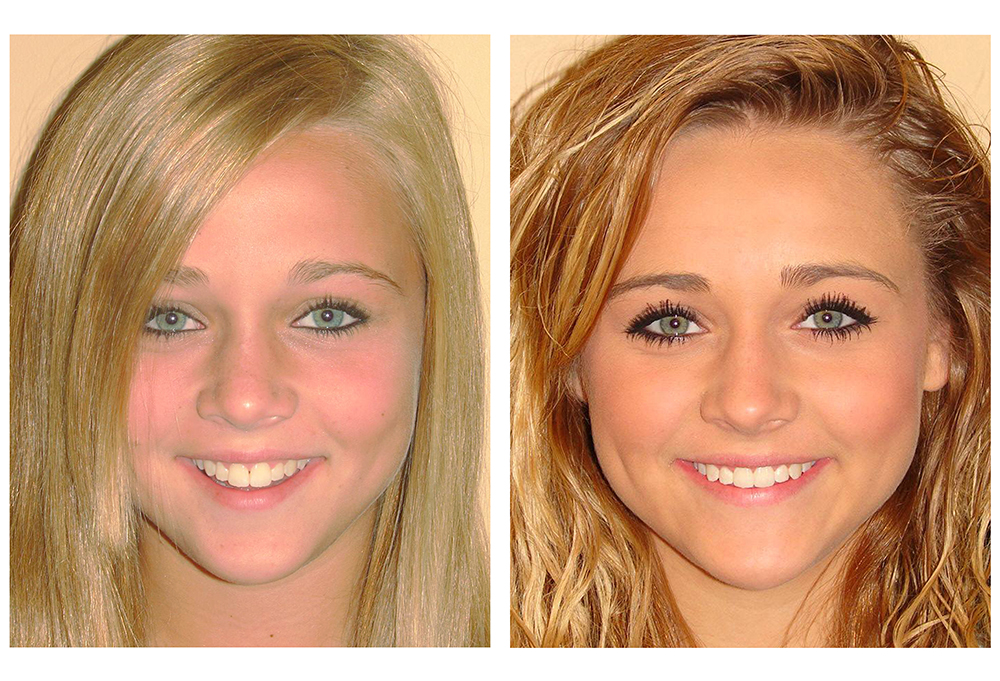 One Smile Aesthetics