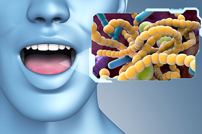 The image features a 3D rendering of a human head with an open mouth, displaying a close-up view of a bacterium or germ. The background includes a graphic representation of the cellular structure of bacteria, emphasizing their microscopic nature.