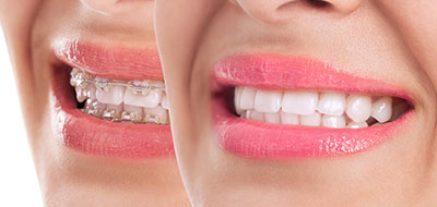 A split-screen image featuring a woman s smiling face with pink lipstick and teeth, showcasing two different shades of lipstick.