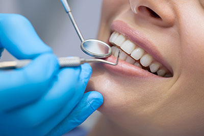 Dental hygiene professional performing teeth cleaning on patient s mouth.