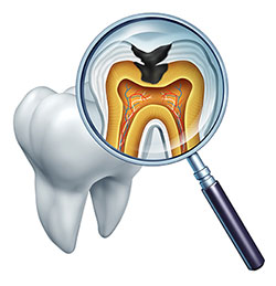 An illustration of a magnified tooth with an internal view highlighting the root canal, pulp chamber, and surrounding tissues, viewed through a magnifying glass.