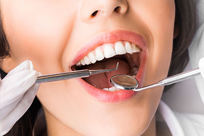 The image shows a woman with an open mouth, surrounded by dental instruments such as a mirror and a probe, indicating a dental examination or treatment in progress.