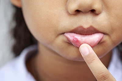 The image shows a close-up of a child s face with a finger touching their lips.