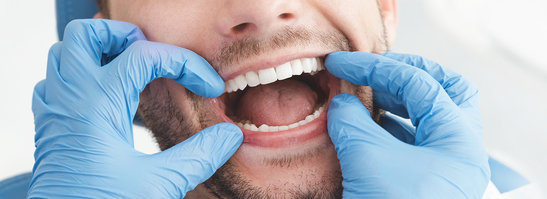 The image shows a man wearing blue surgical gloves and a white face mask, holding his mouth open with his hands, while looking directly at the camera.